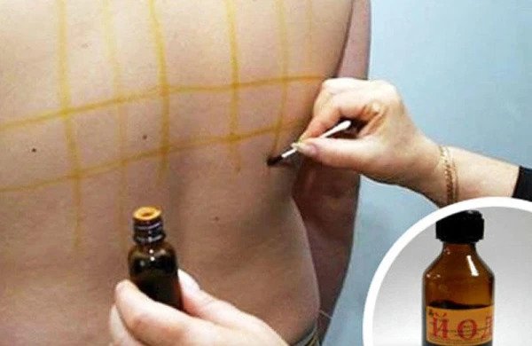 Uşağa yod çəkərkən bu məqamlara diqqət edin - PEDİATR SADALADI