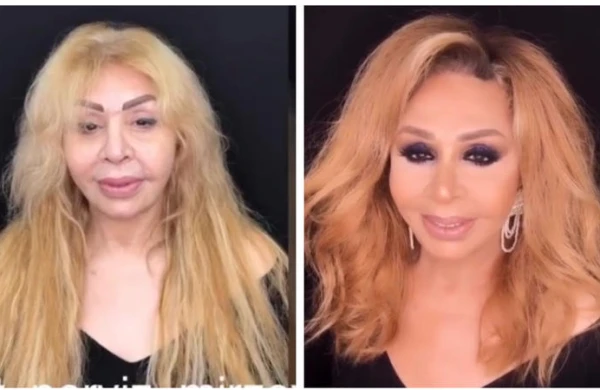 Azərbaycanlı müğənninin makiyajsız görüntüləri təəccüb doğurdu -