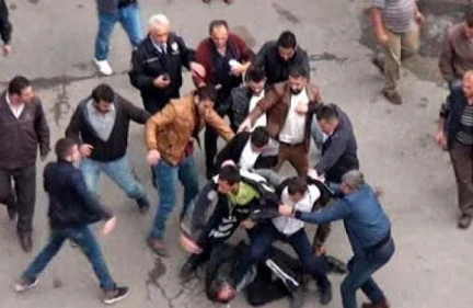 Məktəbdə dava- Müəllim direktorun çənəsini qırdı