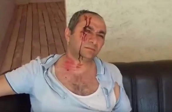 Evini yandıran veteran itkin düşüb - DİQQƏT!