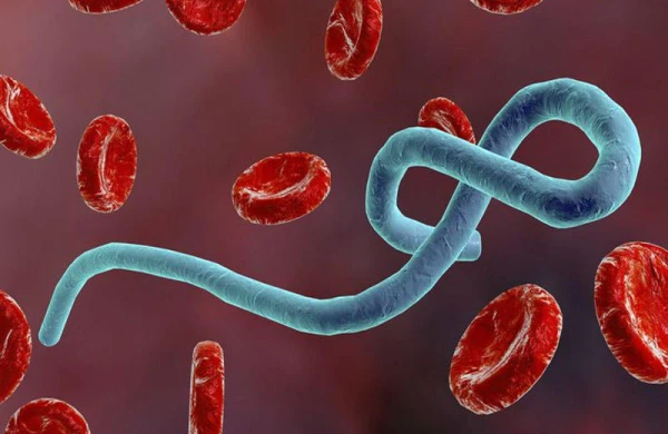 Ölümcül virus qayıtdı - 26 ölü - FOTO