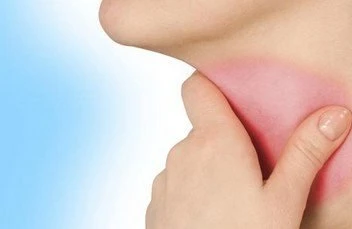 Boğazım qaşınır! Faringit və onunmüalicəsi