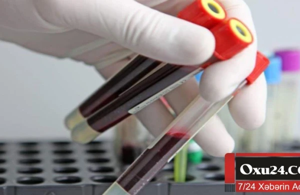 Xərçəng epidemiyasının əsas səbəbi açıqlandı