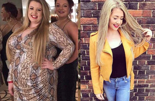 Təhqir olunan qız arıqladı, dəyişdi - FOTO