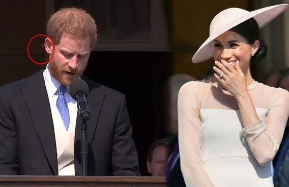 Şahzadənin qulağını arı sancdı – Görün, xanımı nə etdi – VİDEO