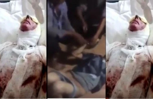 Azərbaycanda dəhşət - Ər arvadını "kislota"yla yandırdı