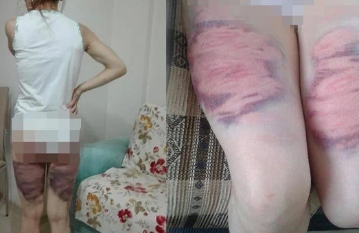 Başqa kişi ilə yazışan arvadını soyundurub oxlovla döydü, bu hala saldı (+18 FOTOLAR)