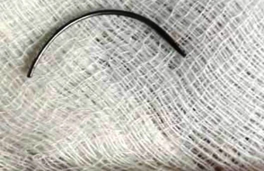 Azərbaycanda deputatın həkim qızı iynəni doğuşa gələn qadının qarnında qoydu - FOTOLAR