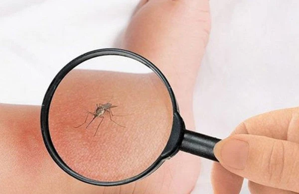 Ağcaqanad dişləyibsə... Qaşınma və şişkinliyi azaldan 7 sadə vasitə