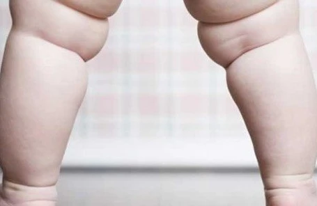 30 yaşına kimi qız kimi böyüdüldü, sonra kişi olduğu üzə çıxdı – Azərbaycanda