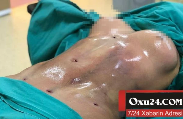 Azərbaycanda plastik cərrah xəstəni bu hala qoyub - Fotolar