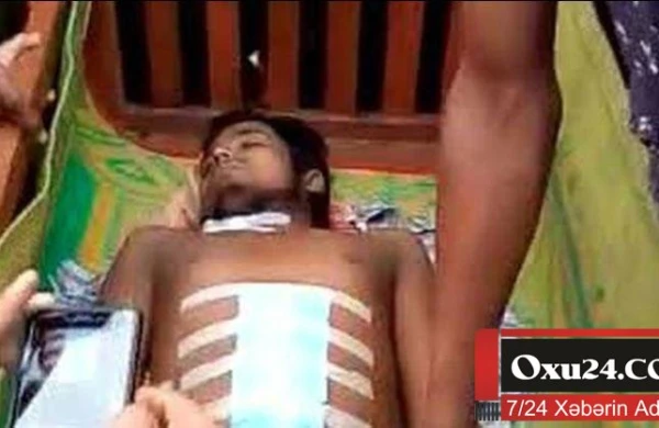 Qarnı ağrıdığına görə xəstəxanaya gedən kişinin cinsiyyət orqanını oğurladılar - FOTO