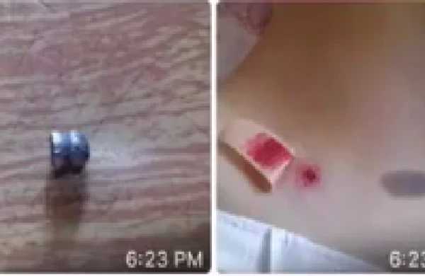 Bakıda qızlara atəş açan manyak peydə olub – ŞOK Video