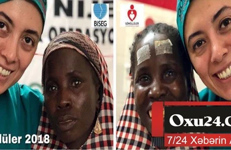 Azərbaycanlı həkim Afrikada 25 illik korun gözlərini açdı