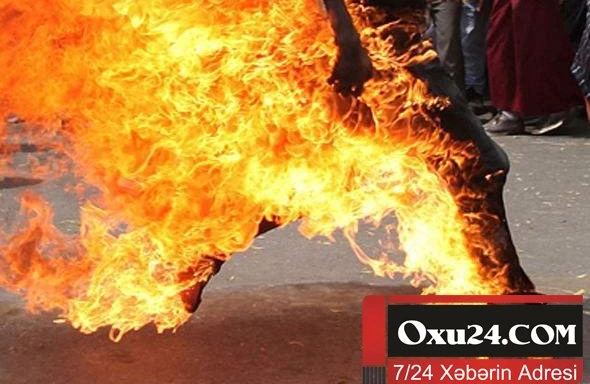 Azərbaycanda universitet müəllimi ÖZÜNÜ YANDIRDI