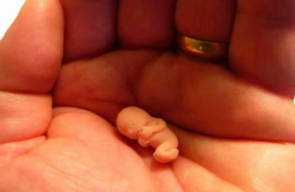 Abort etdirən qadınların nəzərinə! -