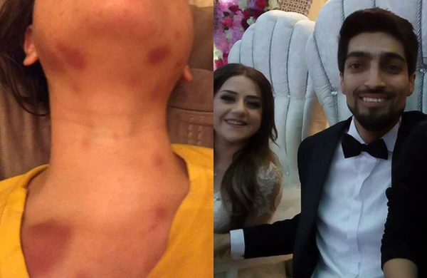 Bakıda jurnalist hamilə arvadını küçədə döyüb -