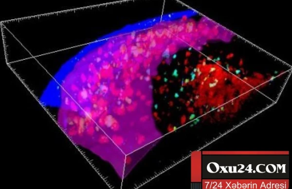 İnsan bədənində yeni orqan aşkarlandı