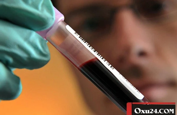 Ölən sevgilisindən hamilə qalacaq