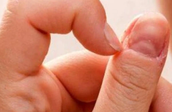 Qadınlarda xərçəng xəstəliyinin 20 əlaməti