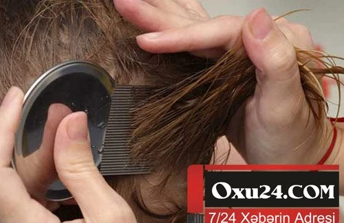 Anaların kabusu: uşağın saçına bit düşərsə..