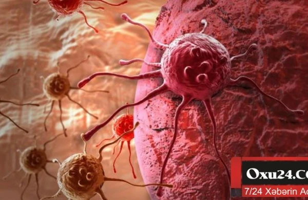 Xərçəng xəstəliyinin diaqnozu daha da asanlaşdı