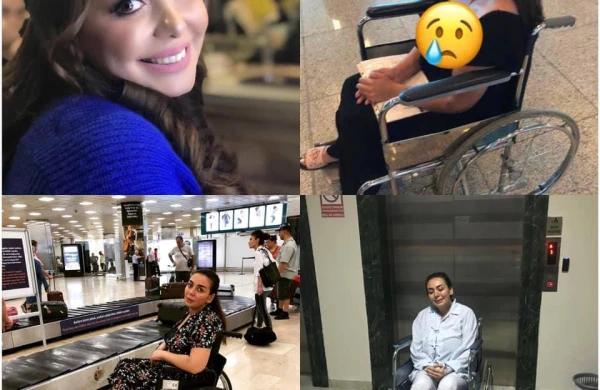 Baş həkimin əməliyyat etdiyi qadın dəhşətli durumda - İnfeksiya ətini yeyir/ FOTOLAR (16+)