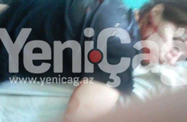 Bakıda dəhşətli hadisə: Ərdən arvadına qarşı amansızlıq - +18 FOTO