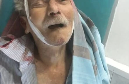 Bakıda ölən piyadanın yaxınları axtarılır - FOTO