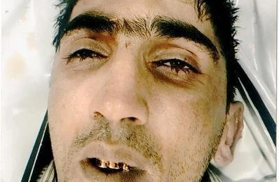 Bakı bulvarında dəhşətli hadisədə ölən şəxs kimdir? - ADI VƏ İNTİHAR SƏBƏBİ