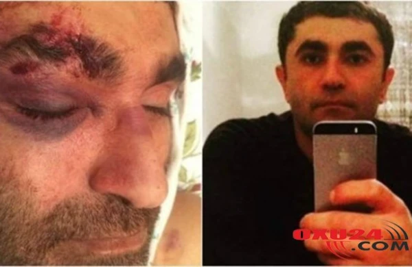 Qazaxdakı ölümə görə daha bir nəfər saxlanıldı - Bu dəfə polis