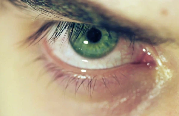 Cinsi gücü artıran dərmanlar görmə qabiliyyətini zəiflədir - Xəbərdarlıq