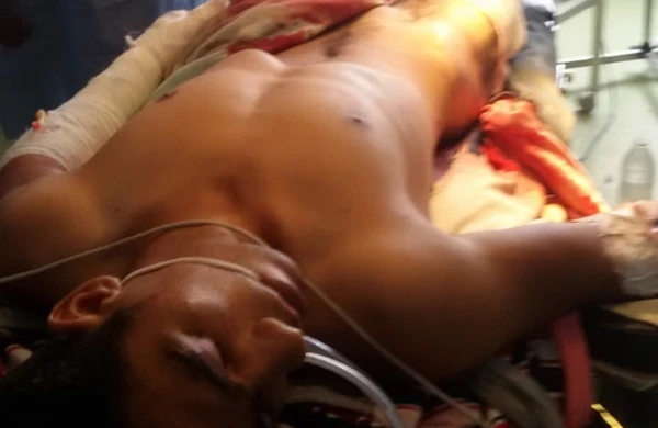 Tərtərdə minaya düşən gəncimizlə bağlı SON XƏBƏR