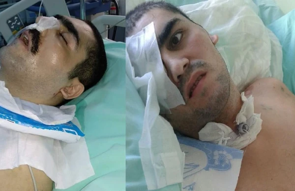 SOS! Aprel döyüşçümüz komaya düşüb! - TƏCİLİ  KÖMƏK LAZIMDIR!