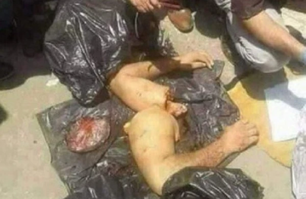 Konsulun iqamətgahında Qaşıqçıya aid qan nümunəsi tapıldı