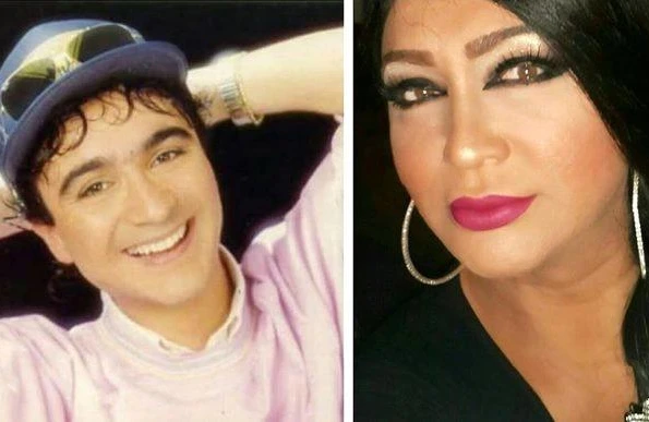 Tanınmış türk müğənni cinsiyyətini dəyişdirdi - FOTO