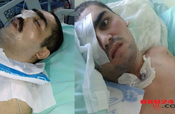 Komada   olan   aprel  döyüşçümüz   Türkiyəyə  göndərilir - Nazirlik hərəkətə keçdi