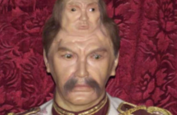 Dünyanın ikibaşlı adamı: Dəfninə qohumları gəlmədi +VİDEO