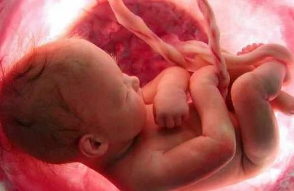 Həm oğlandı, həm qız – Bakıda  qarışıq cinsiyyətli uşaq doğuldu (18+VİDEO)