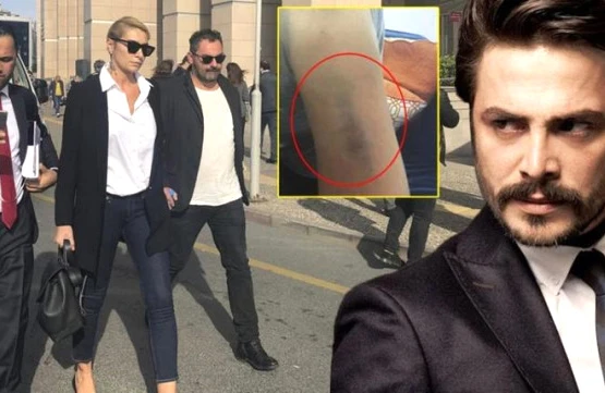 SON DƏQİQƏ! Məşhur aktyor polisə çağırıldı(FOTOLAR+VİDEO)