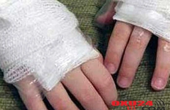 4 uşağın yanıb öldüyü FACİƏNİN TƏFƏRRÜATI: YATIBLARMIŞ...