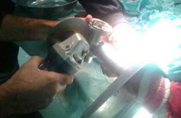 Əli ətçəkən maşında qalan azyaşlı xilas edildi