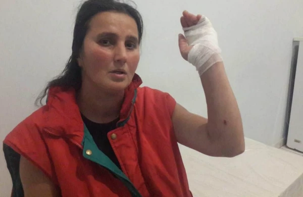 Sumqayıtda qadınlar arasında BIÇAQLAŞMA +FOTO