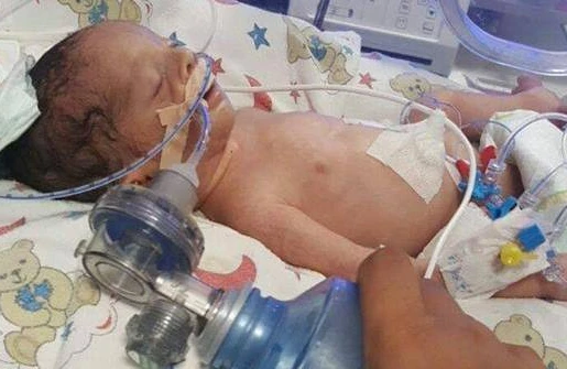 Azərbaycanda  3 günlük körpənin bağırsağı deşildi, 10 sm-lik cürümüş hissə kəsildi –( VİDEO 18+)