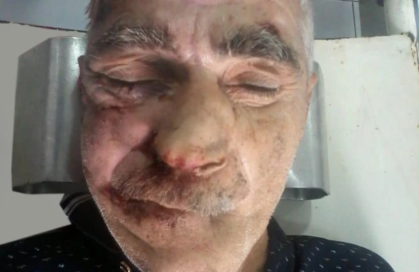 Polis əhaliyə müraciət etdi: Meyit tapılıb, sol əlinə  “Zenfira”,  sol ayağına “Çox sağ ol” yazılıb (FOTO 18+)