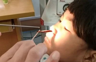 6 yaşlı uşağın burnundan çıxan canlı həkimləri ŞOKA saldı