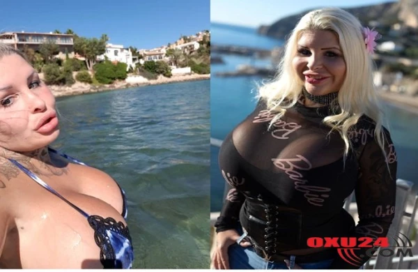 Özünü barbiyə oxşatmaq istədi bu hala düşdü - FOTOLAR