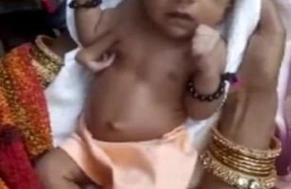 3 qollu doğulan körpəni “peyğəmbər” elan edib ibadət etməyə başladılar