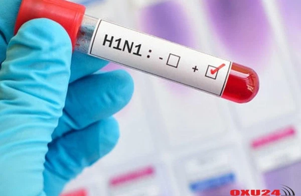 Gürcüstanda “donuz qripi”ndən ölənlərin sayı 8 nəfərə çatıb