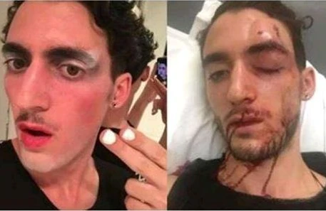 Azərbaycanın  acığına  Qarabağa  gedən fransız  geyin başına görün nə oyun açdılar +FOTOLAR